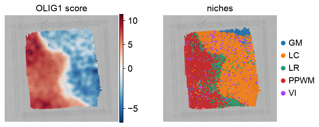 <Figure size 609.6x240 with 3 Axes>